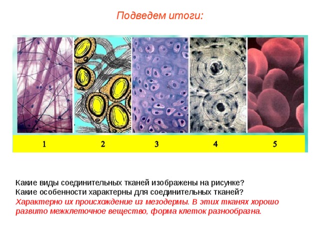 Подведем итоги: Какие виды соединительных тканей изображены на рисунке? Какие особенности характерны для соединительных тканей? Характерно их происхождение из мезодермы. В этих тканях хорошо развито межклеточное вещество, форма клеток разнообразна.  