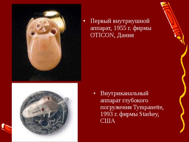 Первый внутриушной аппарат, 1955 г. фирмы OTICON, Дания Внутриканальный аппарат глубокого погружения Tympanette, 1993 г. фирмы Starkey, США 