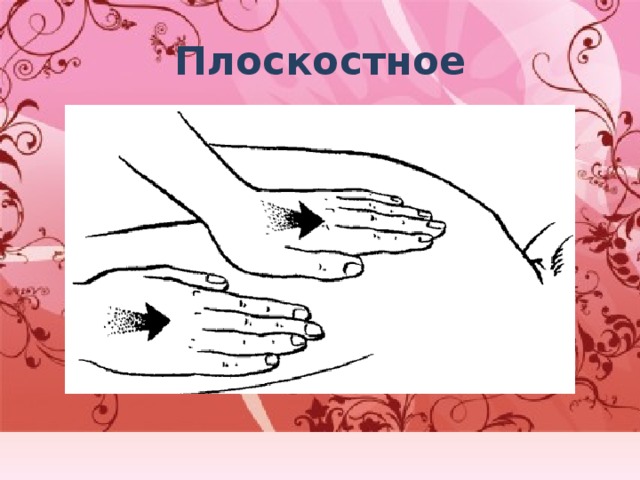 Плоскостное 