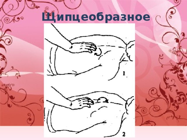 Щипцеобразное 