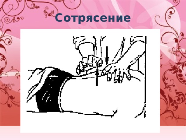 Сотрясение 