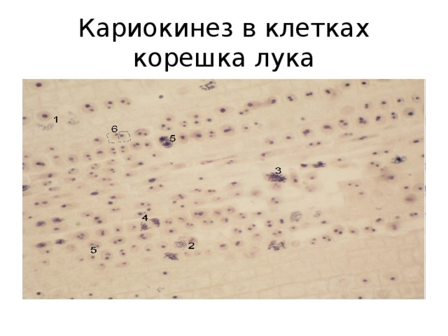 Кариокинез в клетках корешка лука 