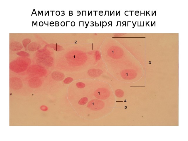 Амитоз в эпителии стенки мочевого пузыря лягушки 