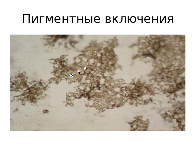 Пигментные включения 