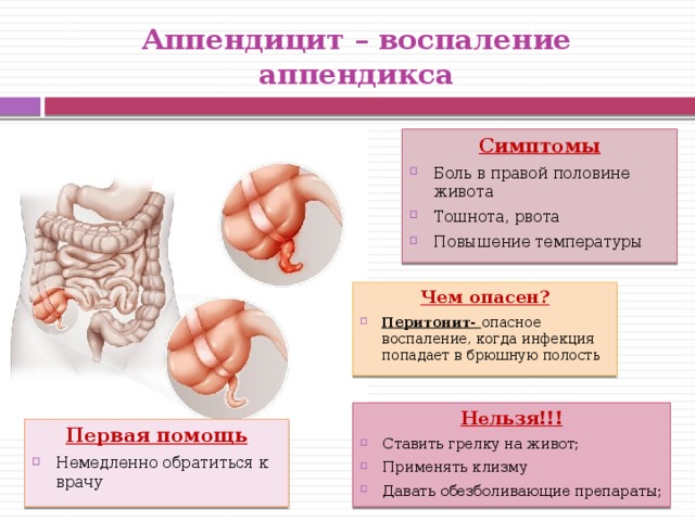 Аппендицит – воспаление аппендикса Симптомы Боль в правой половине живота Тошнота, рвота Повышение температуры Чем опасен? Перитонит- опасное воспаление, когда инфекция попадает в брюшную полость Нельзя!!! Ставить грелку на живот; Применять клизму Давать обезболивающие препараты; Первая помощь Немедленно обратиться к врачу 
