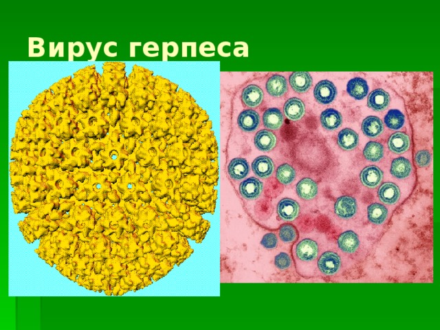 Вирус герпеса 