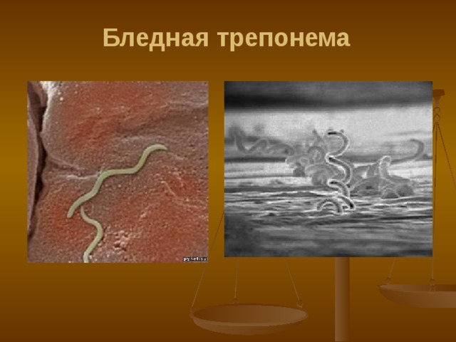 Бледная трепонема 