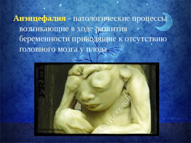 Анэнцефалия - патологические процессы возникающие в ходе развития беременности приводящие к отсутствию головного мозга у плода . 
