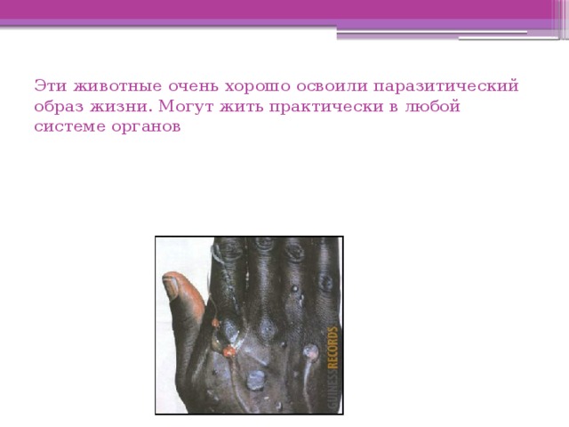 Эти животные очень хорошо освоили паразитический образ жизни. Могут жить практически в любой системе органов 