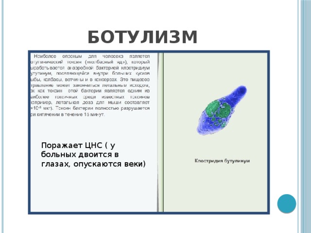 Ботулизм Поражает ЦНС ( у больных двоится в глазах, опускаются веки) 