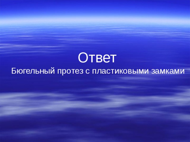 Ответ Бюгельный протез с пластиковыми замками 