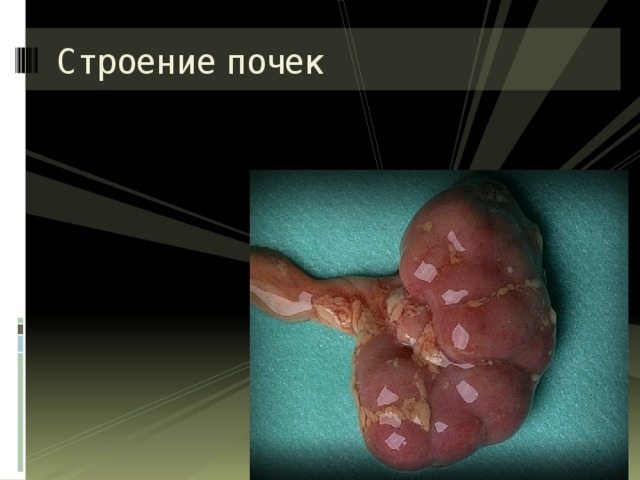Строение почек 