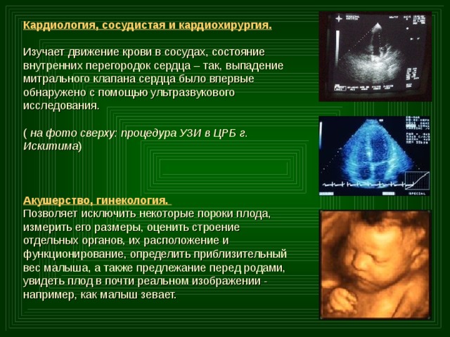 Кардиология, сосудистая и кардиохирургия.  Изучает движение крови в сосудах, состояние внутренних перегородок сердца – так, выпадение митрального клапана сердца было впервые обнаружено с помощью ультразвукового исследования. ( на фото сверху: процедура УЗИ в ЦРБ г. Искитима ) Акушерство, гинекология. Позволяет исключить некоторые пороки плода, измерить его размеры, оценить строение отдельных органов, их расположение и функционирование, определить приблизительный вес малыша, а также предлежание перед родами, увидеть плод в почти реальном изображении - например, как малыш зевает. 