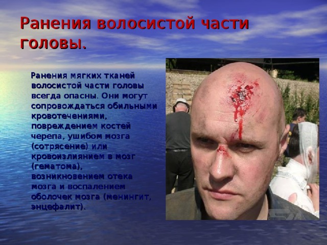 Ранения волосистой части головы.    Ранения мягких тканей волосистой части головы всегда опасны. Они могут сопровождаться обильными кровотечениями, повреждением костей черепа, ушибом мозга (сотрясение) или кровоизлиянием в мозг (гематома), возникновением отека мозга и воспалением оболочек мозга (менингит, энцефалит). Ранения мягких тканей волосистой части головы всегда опасны. Они могут сопровождаться обильными кровотечениями, повреждением костей черепа, ушибом мозга (сотрясение) или кровоизлиянием в мозг (гематома), возникновением отека мозга и воспалением оболочек мозга (менингит, энцефалит). Признаками повреждений мозга и костей черепа, развития воспалительных осложнений являются головная боль, тошнота, нарушения зрения и чувствительности кожи конечностей или слабость в них, подъем температуры тела, помрачение сознания вплоть до его потери  