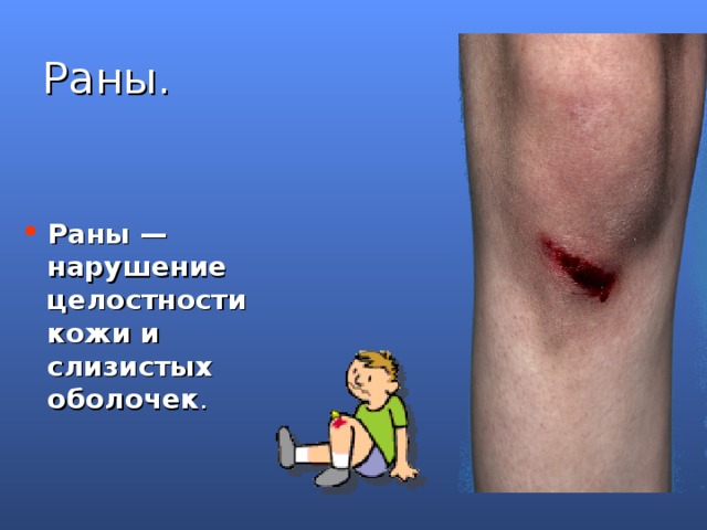 Раны. Раны — нарушение целостности кожи и слизистых оболочек .  Раны — нарушение целостности кожи и слизистых оболочек. Они разнообразны по размеру, форме, глубине и т.д.  