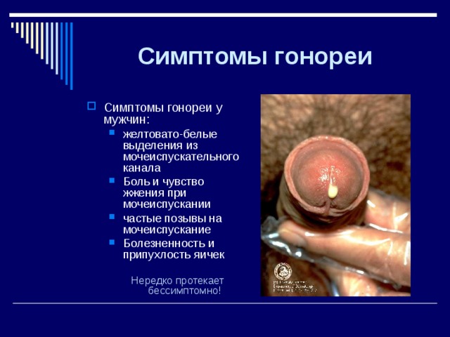 Симптомы  гонореи Симптомы гонореи у мужчин: желтовато-белые выделения из мочеиспускательного канала Боль и чувство жжения при мочеиспускании частые позывы на мочеиспускание Болезненность и припухлость яичек желтовато-белые выделения из мочеиспускательного канала Боль и чувство жжения при мочеиспускании частые позывы на мочеиспускание Болезненность и припухлость яичек Нередко протекает бессимптомно!  Нередко протекает бессимптомно! 