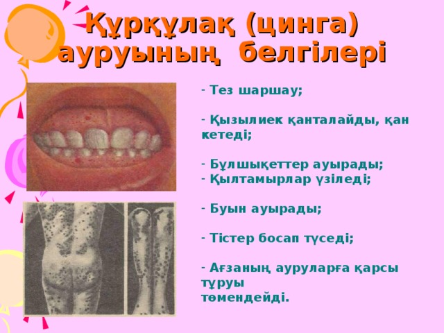 Құрқұлақ (цинга) ауруының белгілері  Тез шаршау;  Қызылиек қанталайды, қан кетеді;  Бұлшықеттер ауырады;  Қылтамырлар үзіледі;  Буын ауырады;  Тістер босап түседі;  Ағзаның ауруларға қарсы тұруы төмендейді. 