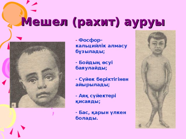 Мешел (рахит) ауруы  Фосфор–кальцийлік алмасу бұзылады;  Бойдың өсуі баяулайды;  Сүйек беріктігінен айырылады;  Аяқ сүйектері қисаяды;  Бас, қарын үлкен болады. 