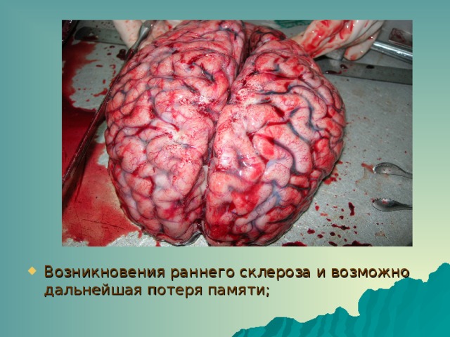 Возникновения раннего склероза и возможно дальнейшая потеря памяти; 