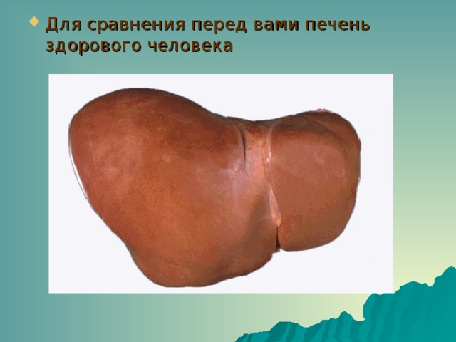 Для сравнения перед вами печень здорового человека 