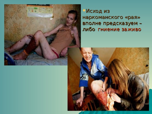Исход из наркоманского «рая» вполне предсказуем – либо  гниение заживо 