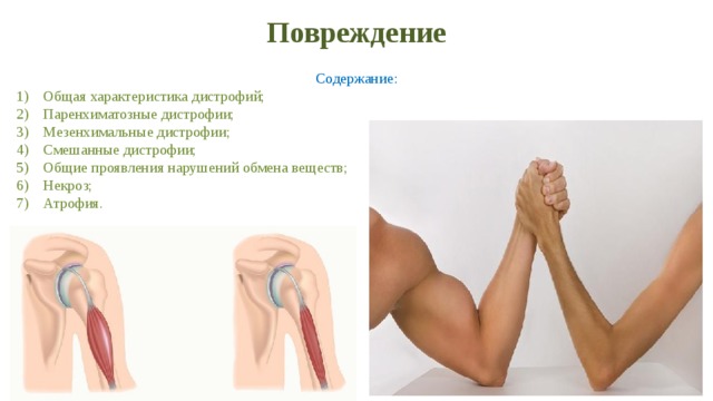 Повреждение Содержание: Общая характеристика дистрофий; Паренхиматозные дистрофии; Мезенхимальные дистрофии; Смешанные дистрофии; Общие проявления нарушений обмена веществ; Некроз; Атрофия. 