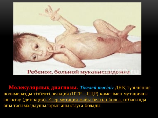   Молекулярлық диагнозы. Тікелей тәсілі:  ДНҚ түзілісінде полимеразды тізбекті реакция (ПТР – ПЦР) көмегімен мутацияны анықтау (детекция). Егер мутация жайы белгілі болса, отбасында оны тасымалдаушыларын анықтауға болады. 