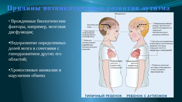 Причины возникновения и развития аутизма  Врожденные биологические факторы, например, мозговая дисфункция; Недоразвитие определенных долей мозга в сочетании с гиперразвитием других его областей; Хромосомные аномалии и нарушения обмена 