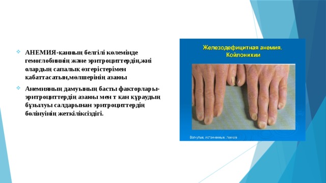 АНЕМИЯ-қанның белгілі көлемінде гемоглобиннің және эритроциттердің,жиі олардың сапалық өзгерістерімен қабаттасатын,мөлшерінің азаюы Анемияның дамуының басты факторлары-эритроциттердің азаюы мен т қан құраудың бұзылуы салдарынан эритроциттердің бөлінуінің жеткіліксіздігі.  
