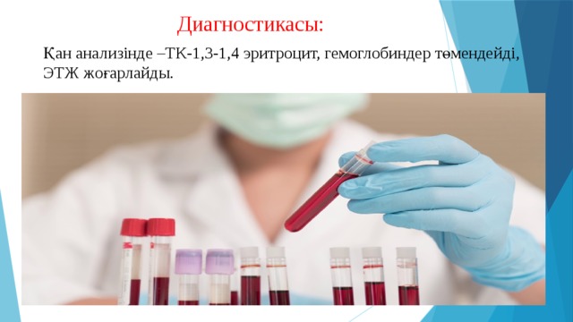  Диагностикасы: Қан анализінде –ТК-1,3-1,4 эритроцит, гемоглобиндер төмендейді, ЭТЖ жоғарлайды. 