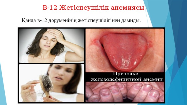 В-12 Жетіспеушілік анемиясы Қанда в-12 дәруменінің жетіспеушілігінен дамиды. 