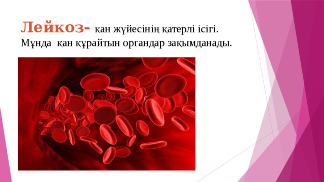 Лейкоз-  қан жүйесінің қатерлі ісігі. Мұнда қан құрайтын органдар зақымданады.   