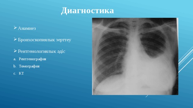 Диагностика Анамнез Бронхоскопиялық зерттеу Рентгенологиялық әдіс Рентгенография Томография КТ 