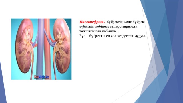 Пиелонефрит - бүйректің және бүйрек түбегінің көбінесе интерстициялық талшығының қабынуы.  Бұл – бүйректің ең жиі кездесетін ауруы. 