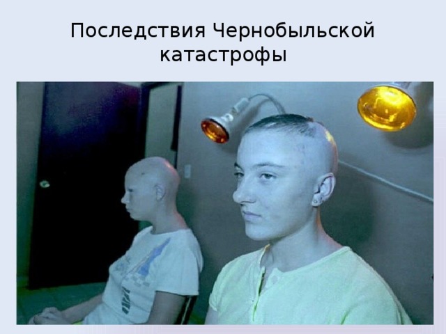 Последствия Чернобыльской катастрофы 