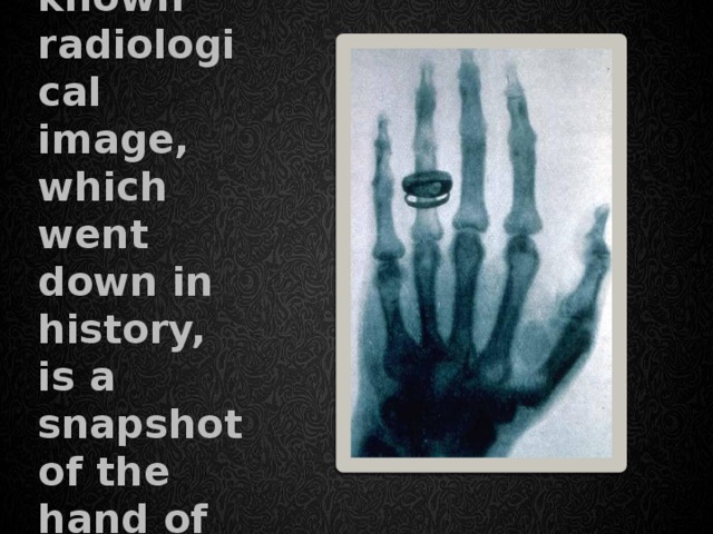 On the photo The first known radiological image, which went down in history, is a snapshot of the hand of the scientist's wife. 