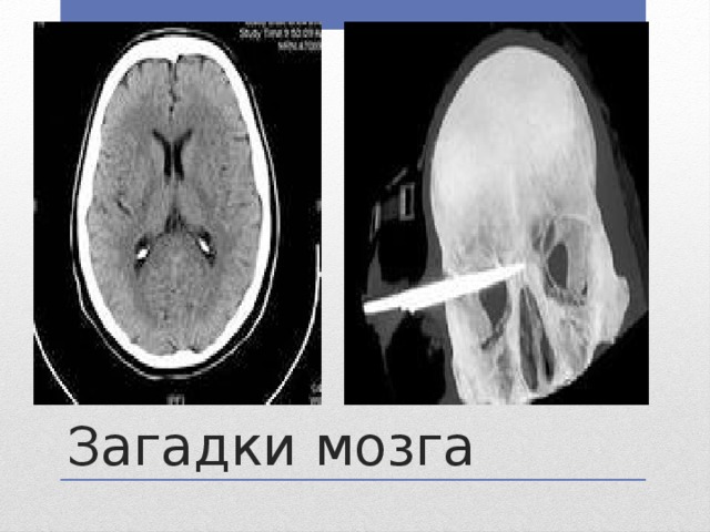 Загадки мозга