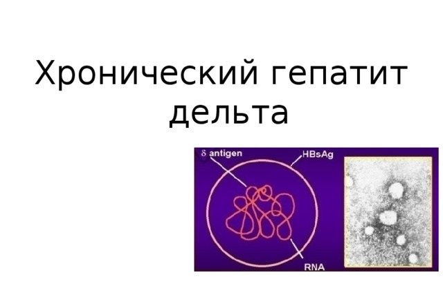 Хронический гепатит дельта  