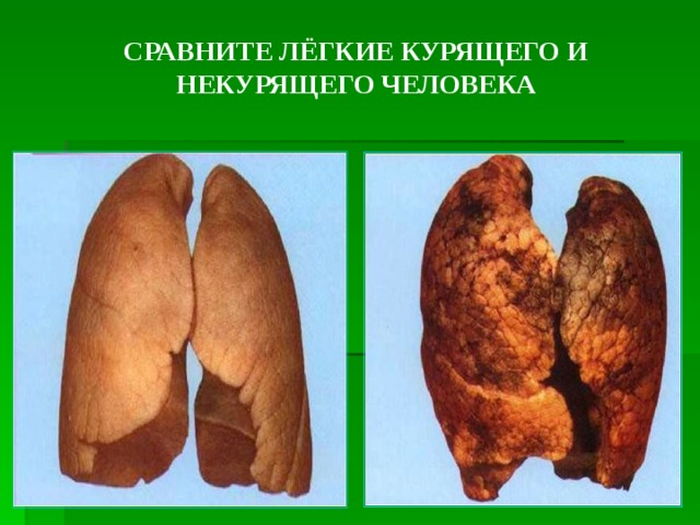 СРАВНИТЕ ЛЁГКИЕ КУРЯЩЕГО И НЕКУРЯЩЕГО ЧЕЛОВЕКА   
