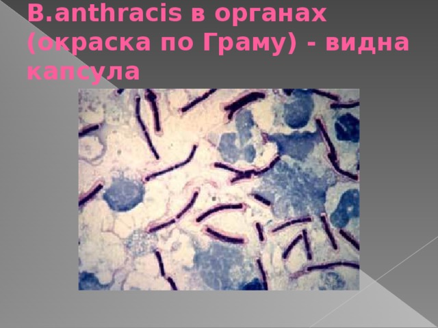 B.аnthracis в органах (окраска по Граму) - видна капсула  