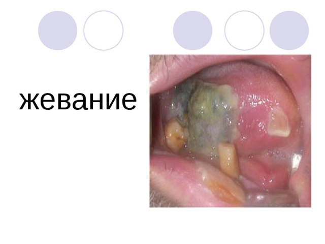 жевание 