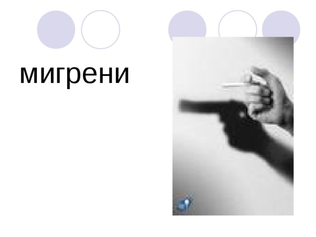 мигрени 