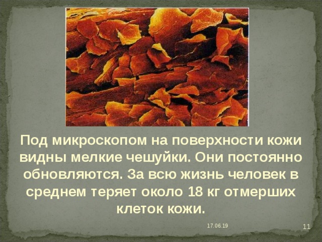 Под микроскопом на поверхности кожи видны мелкие чешуйки. Они постоянно обновляются. За всю жизнь человек в среднем теряет около 18 кг отмерших клеток кожи. 8 17.06.19 
