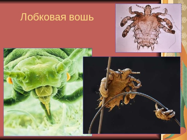 Лобковая вошь 