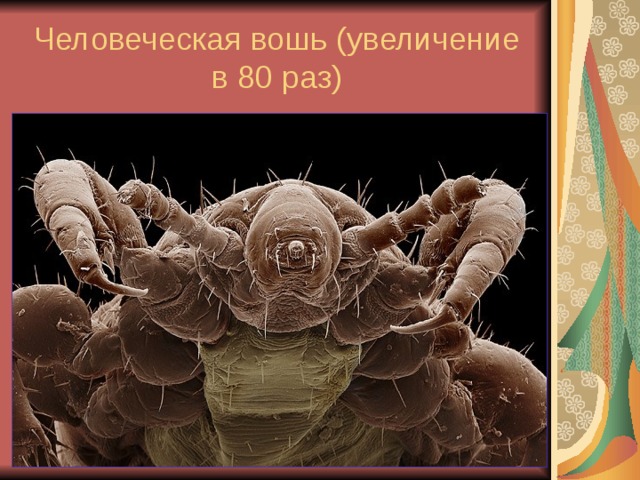 Человеческая вошь (увеличение в 80 раз) 