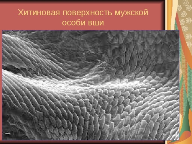 Хитиновая поверхность мужской особи вши 