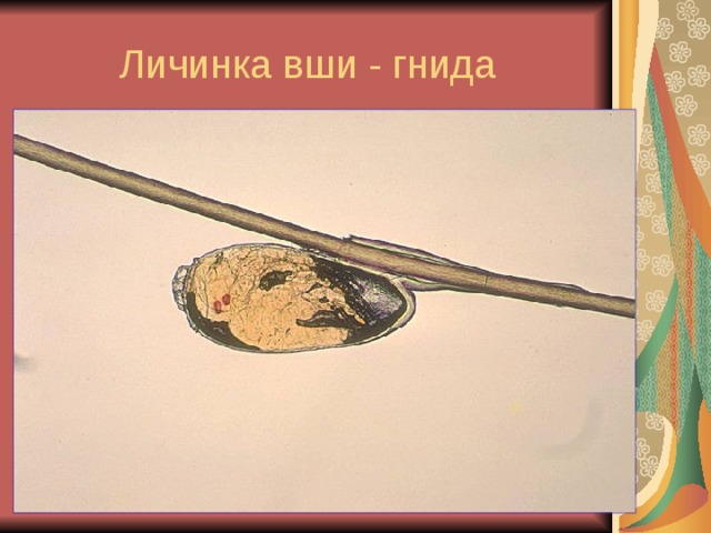 Личинка вши - гнида 