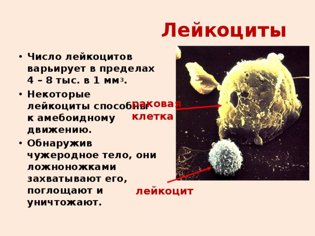 Лейкоциты Число лейкоцитов варьирует в пределах 4 – 8 тыс. в 1 мм 3 . Некоторые лейкоциты способны к амебоидному движению. Обнаружив чужеродное тело, они ложноножками захватывают его, поглощают и уничтожают. раковая клетка лейкоцит 
