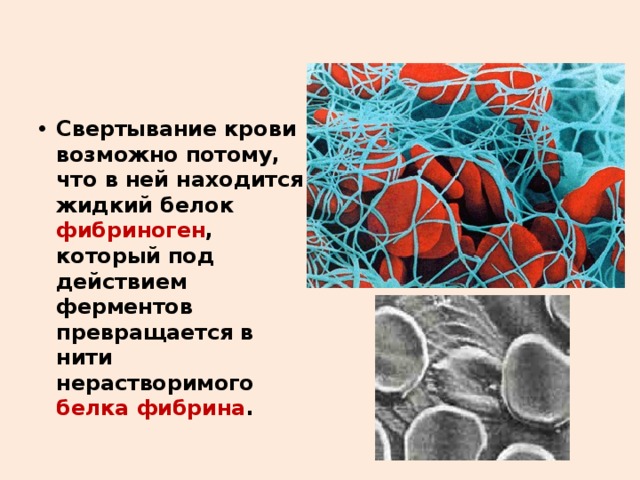 Свертывание крови возможно потому, что в ней находится жидкий белок фибриноген , который под действием ферментов превращается в нити нерастворимого белка фибрина . 