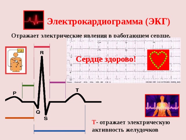 Электрокардиограмма (ЭКГ) Отражает электрические явления в работающем сердце. P - отражает электрическую активность предсердий Сердце здорово! QRS - отражает электрическую проводимость желудочков Т - отражает электрическую активность желудочков 